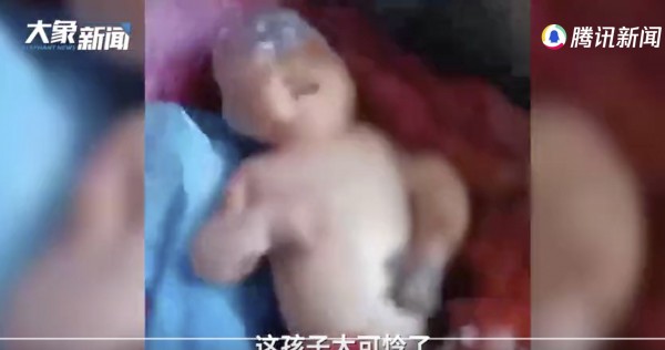 Father in China abandons infant son injured by fire and steals donations, China News thumbnail