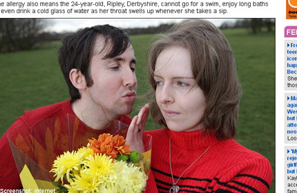 Woman so allergic to water she cannot kiss fiancé