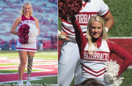 One-legged cheerleader proves 'anything is possible'