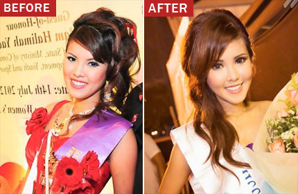 S'pore blogger admits to having cosmetic surgery to make more money