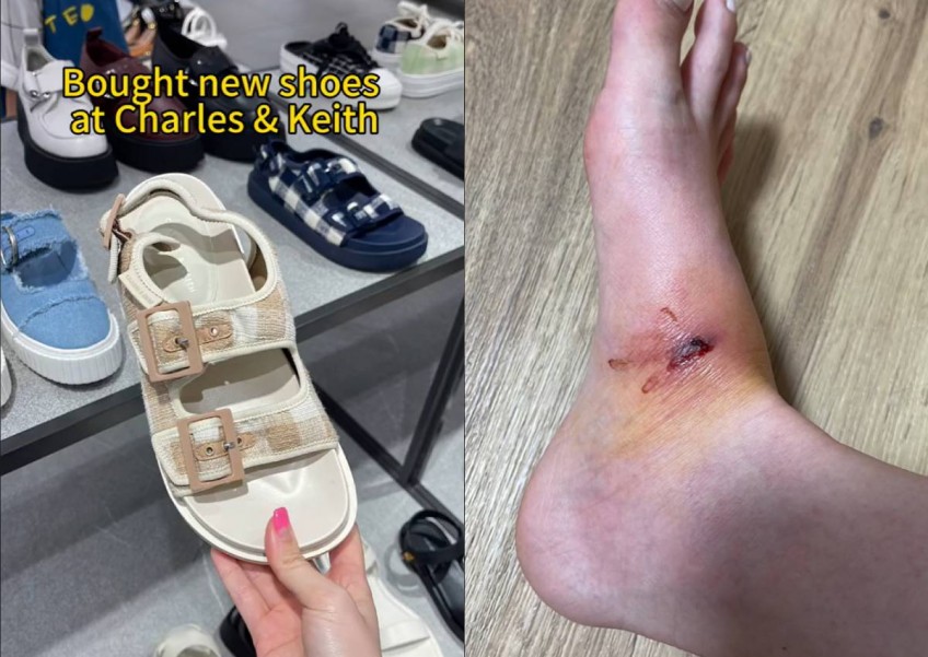'A tiny cut became a pig trotter': Woman's foot gets infected after wearing new shoes from Charles & Keith