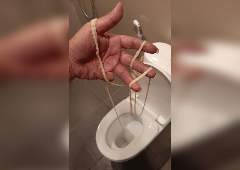 Thai man takes a dump, finds 10m-long tapeworm hanging from his butt