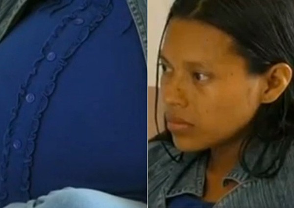 Doctors in Peru remove 16kg tumour from woman's abdomen