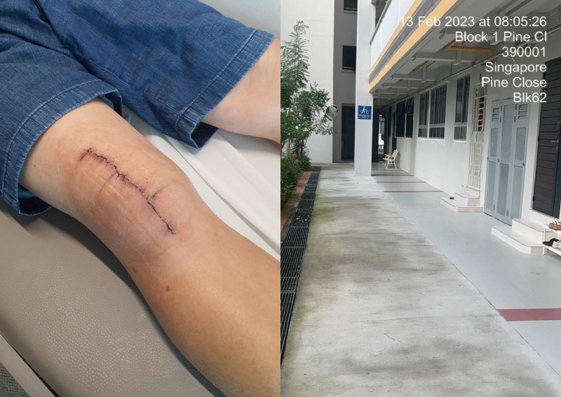 'I suffered great pain': Man blames 'slippery' paint after breaking kneecap in fall along common corridor