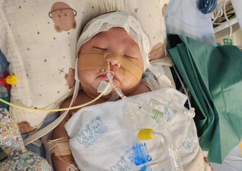 'It hurts as a parent': Month-old baby with heart defect has suffered 2 strokes and had 2 ops; family raising money for treatment