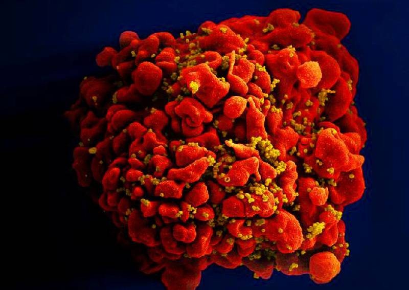 Oldest patient yet cured of HIV after stem cell transplant: Researchers