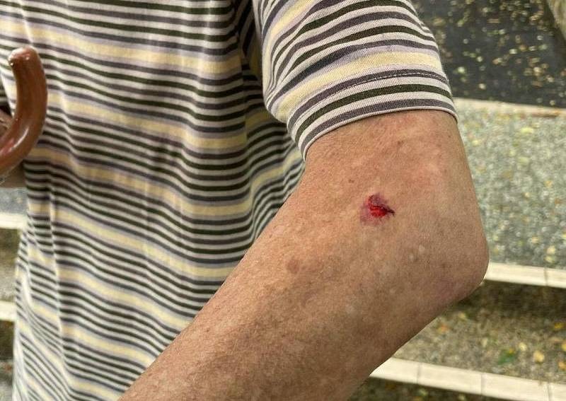 Man hit by car, father scratched after scuffle with taxi driver over rude hand gesture