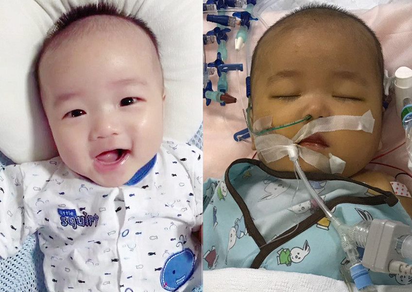 Woman donates part of liver to save 6-month-old boy's life