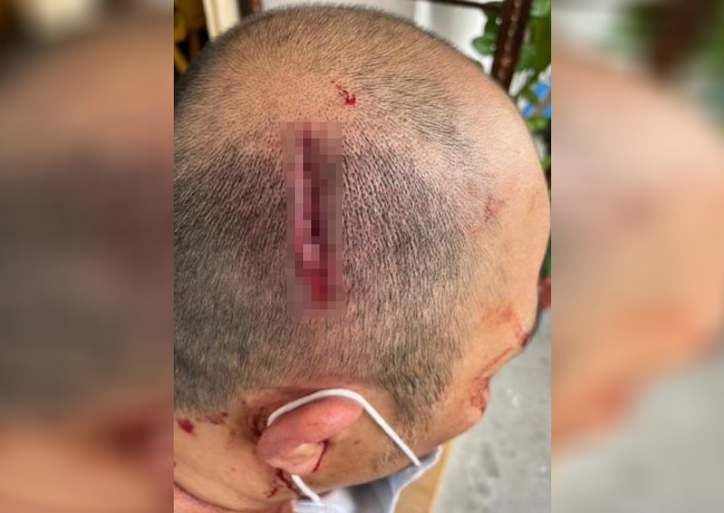 'I was dizzy from being beaten up': Man left with gash in head after neighbour allegedly attacks him with chain 