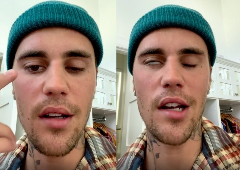 My sickness is getting worse': Justin Bieber reveals half of left paralysed virus, Entertainment News -