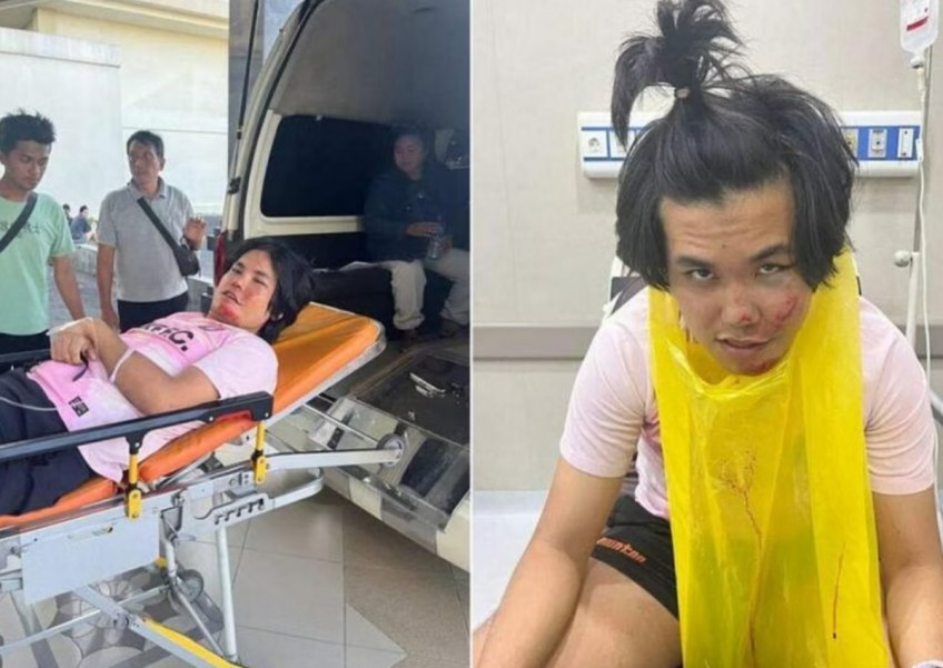 'I can't even remember being in Bali': Singapore student suffers fracture, memory loss after all-terrain vehicle hits tree in Bali