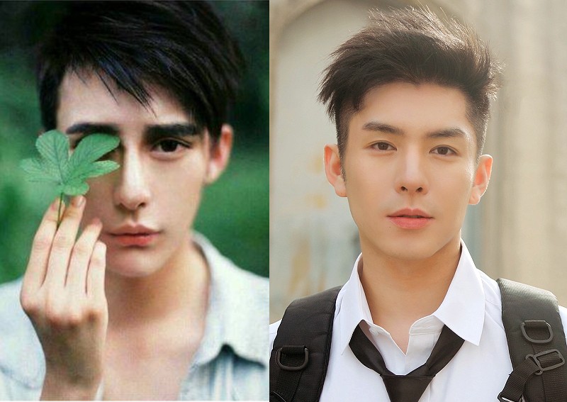 Medical Miracle': Chinese Actor Re-Does Cosmetic Surgeries, Now A Legit  Heartthrob, Entertainment News - Asiaone