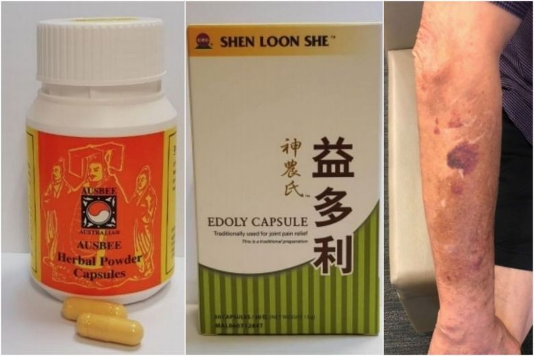 HSA issues alert on 2 health products from Malaysia containing steroids