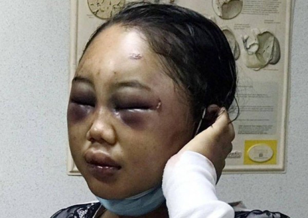 Daily roundup: Maids beaten with hammer, slept with dog, starved - and other top stories today