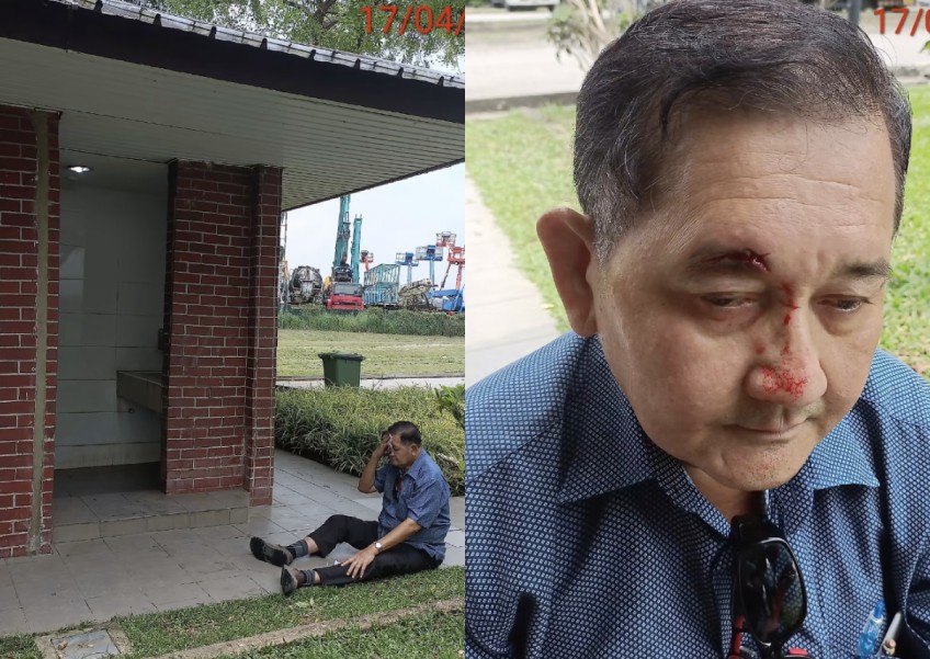 Man gets 20 stitches on face after tripping over steps outside Kranji Reservoir toilet