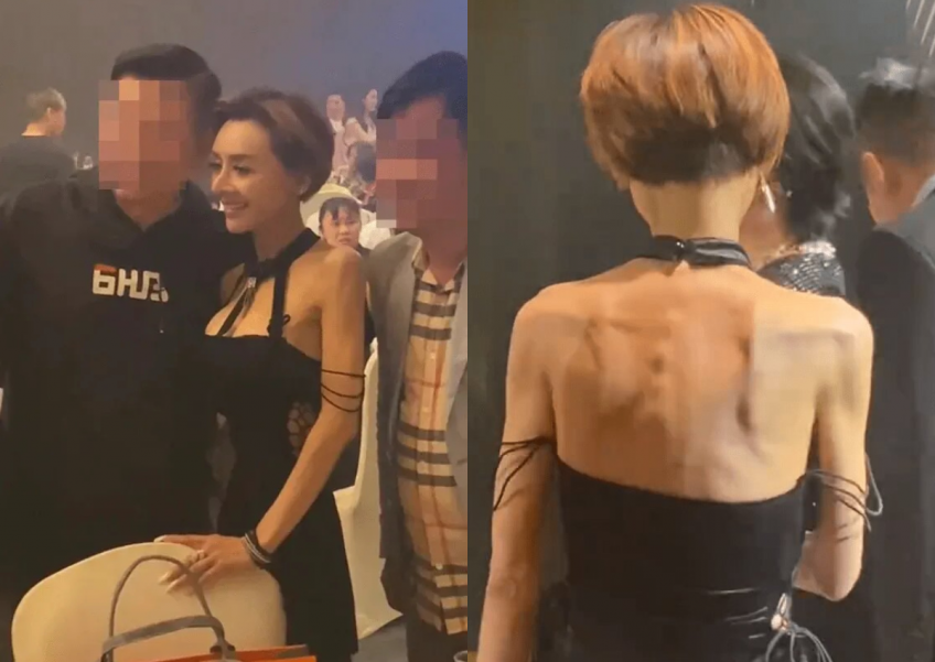 '80s star Amy Yip shocks netizens with thin appearance: 'The protruding bones on her back are so terrifying' 