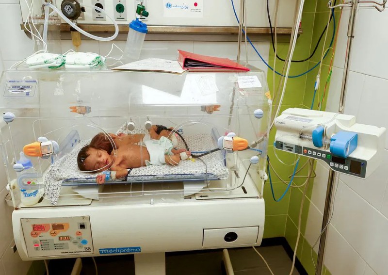 More premature babies born in Gaza due to stress, trauma