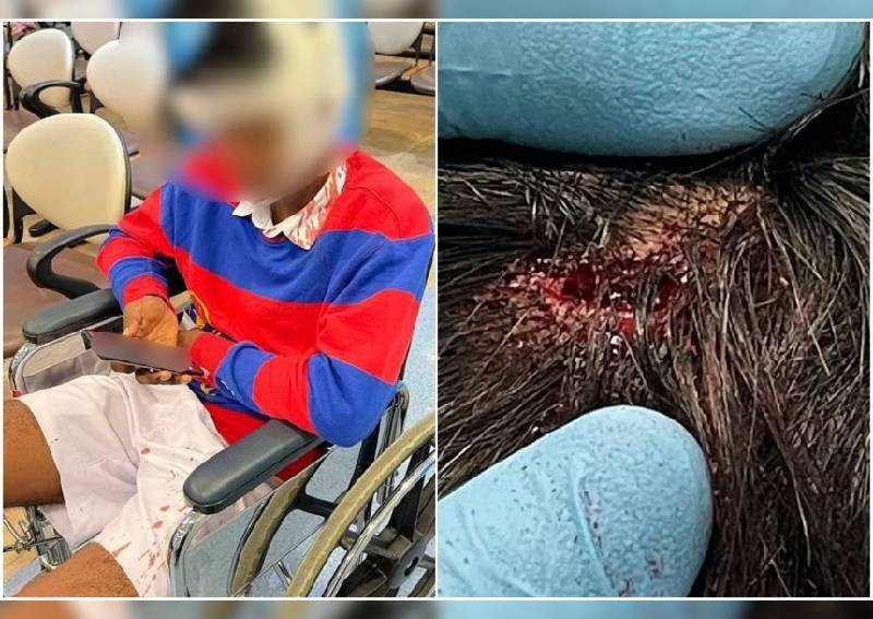 Secondary school student arrested for allegedly attacking schoolmate with metal rod, leaving gaping wound