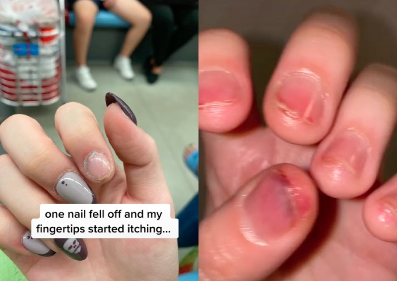 Daily roundup: Woman says manicure gave her blisters and pus on fingers — and other top stories today