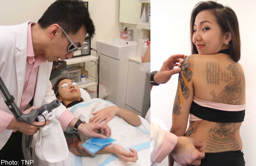 California Today: Starting Over, With the Help of Tattoo Removal - The New  York Times
