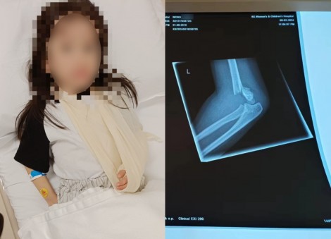 Dad files police report after woman bumped into 4-year-old daughter at Marsiling, fracturing her arm