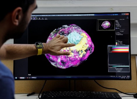 Israeli scientists create model of human embryo without eggs or sperm